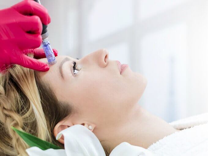 Effet Glow durableQuestion-réponse-microneedling