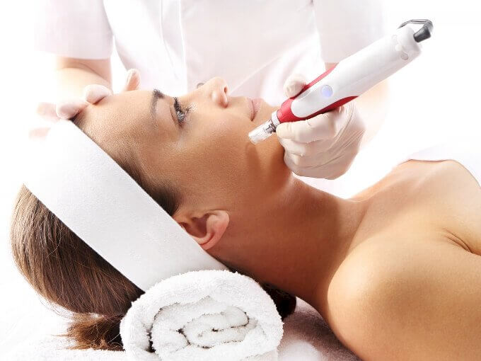 Le Micro Needling Dermo Expert